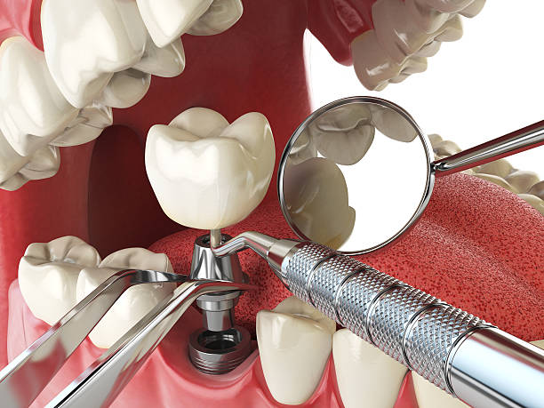 Best Tooth Pain Emergency Relief  in Preston, TX